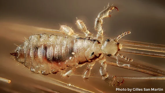 head lice dos and don'ts